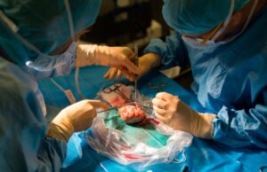 Pig Kidney Removed from Patient After 130 Days: Shocking Ending to Historic Breakthrough Pig Kidney Removed from Patient After 130 Days: Shocking Ending to Historic Breakthrough