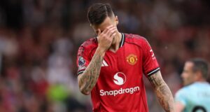 Man United Striker Benjamin Sesko Sidelined With Knee Injury Man United Striker Benjamin Sesko Sidelined With Knee Injury