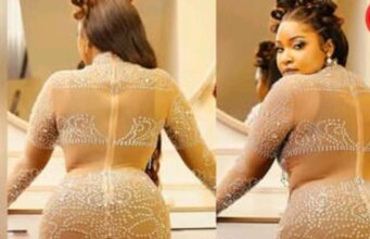 “Haijakauka” Lydia Wanjiru Reveals She Has Not Sat Down For 5 Weeks After Her Ksh.2M BBL Surgery to Get Big Behind Photo Courtesy